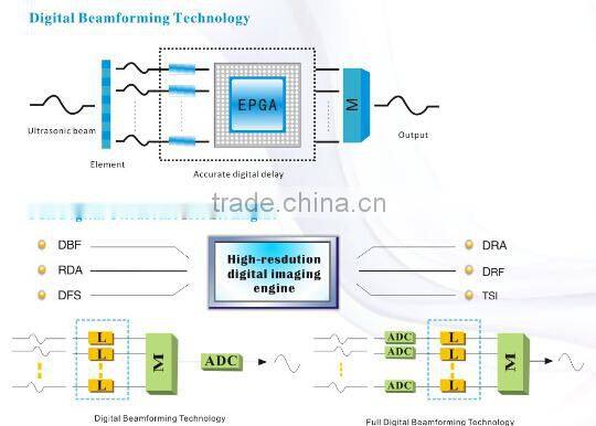 (Pregnant week,fetal weight,volume.etc) Both use in human and animal new portable laptop ultrasound machine/scanner/system price