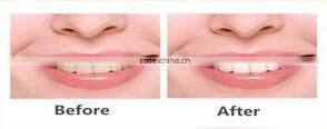 Dental Teeth Whitening Strips in teeth whitening