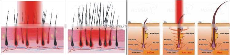 Hair growth laser! wholesale skin treatment anti wrinkle BL005, CE/ISO