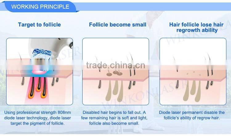 Beijing Diode Laser Machine / Hair Removal Diode Laser 808nm For Sale / 808nm Diode Laser Machine For Beauty Salon