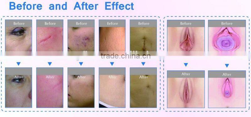 business industrial 3d cnc laser acrylic carving co2 laser cutter for wood leather,plastic mdf laser cutting machine price