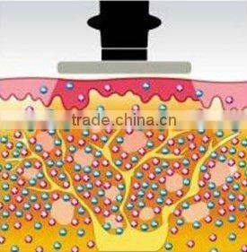 2012 RF and Cryo Meso Face Action Beauty Machine