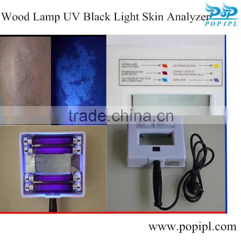 china Wood's lamp UV 3D Skin Analyzer B601 UV black light factory F102