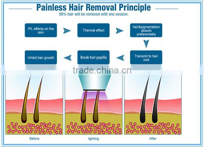 aesthetics equipment diodo laser hair removal machine