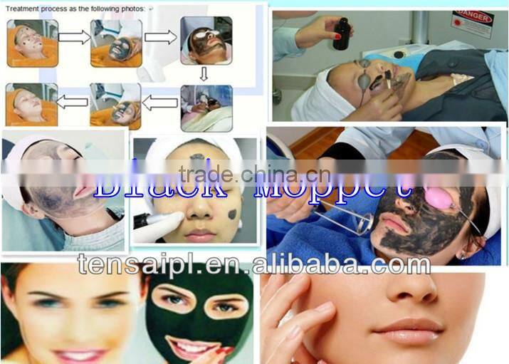 High Power Profeesional Q switch nd yag laser tattoo removal beauty machine