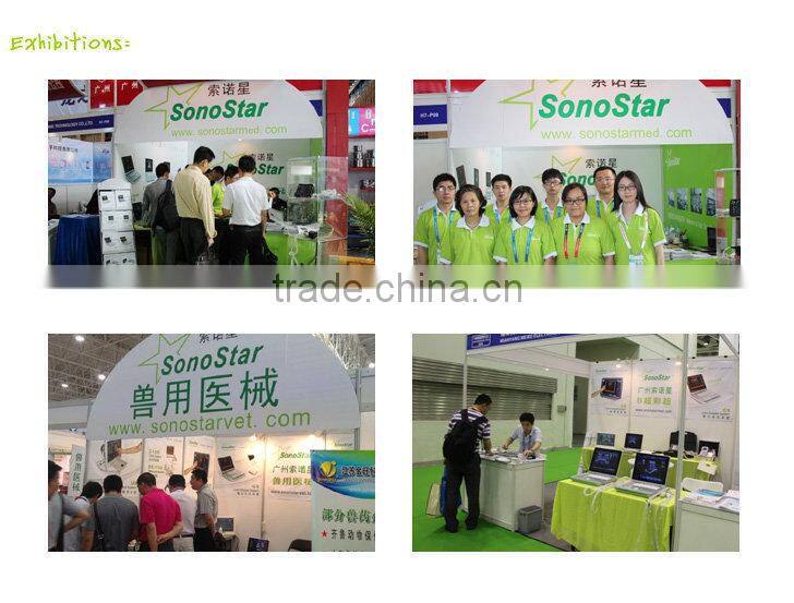 CareScan-1 Bladder Scanner Diagonosis Portable Scanner