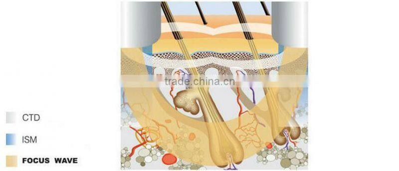 AYJ-T05 (CE)rf fractional micro needle/fractional rf microneedle machine/rf machine for home use