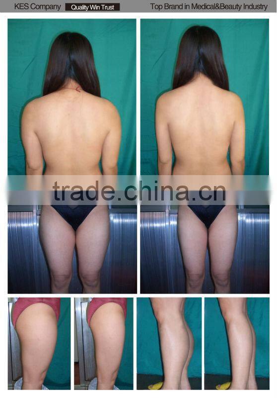 cellulite reduction spa slimming machine