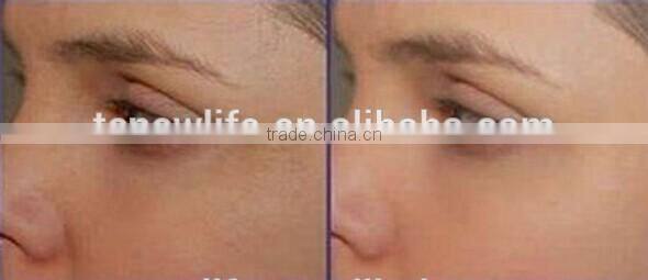 NL-PDT500 BEST ! 2016 Salon Equipment PDT Therapy Machine LED Light Red Blue Yellow for Skin Whitening