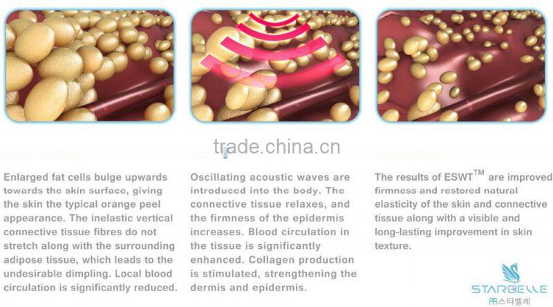 portable beauty system acoustic shockwave for cellulite removal device - ESWT SD