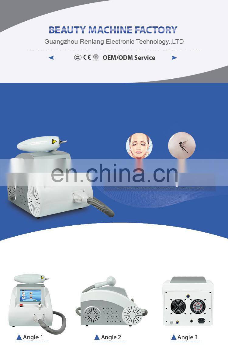 Europe best laser 1064 nm 532nm nd yag laser tattoo removal machine price