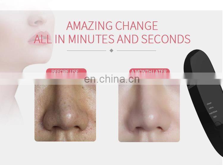 2019 Newest Multi-functional Ultrasonic Facial Cleansing Massage Skin Scrubber Home Use