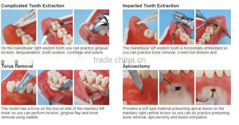 Oral Surgery Jaw Model