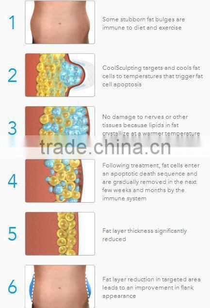 Promotion!!! CE approved newest cryo lipolysis body slimming devices