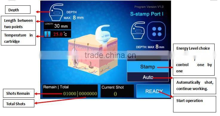 LANGDI fat killer top grade HIFU shape slimming machine