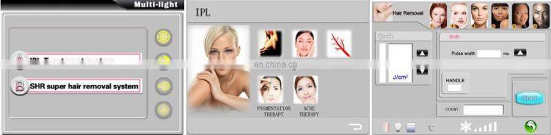 2019 New Elight Opt Laser Ipl Hair Removal Top Sellers