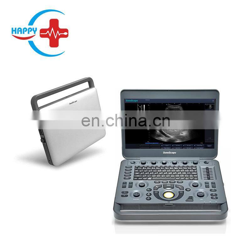 Cheap medical Sonoscape x3 ultrasound machine/Laptop ultrasound scanner/Portable ultrasound probe