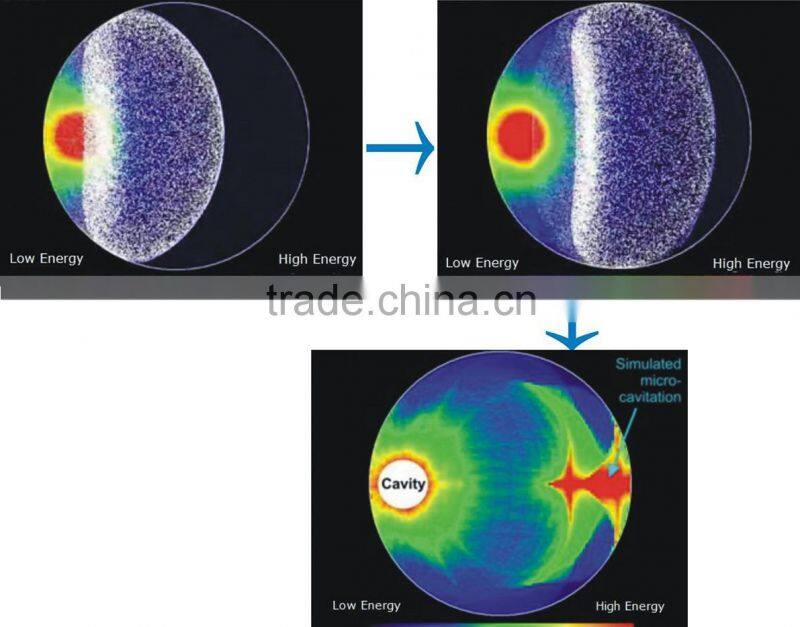 Cavitation Lose Weight Ultrasonic Cellulite Reduction