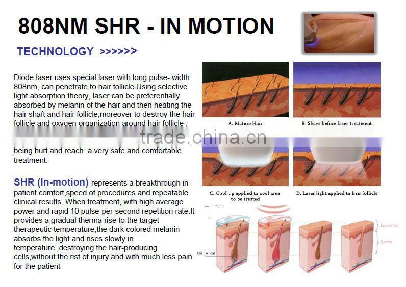 2015 hair removal machine/epilator hair removal 808 diode laser for man hair removal