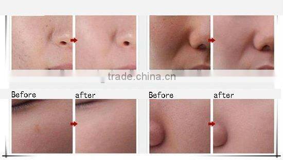 S0-07 Almighty Skin Oxyen Spray Beauty Instrument