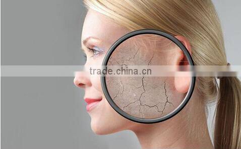 Medical CE Approved IPL Hair Removal Beauty equipment