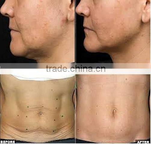 Hot!! fractional rf/rf fractional micro needle/RF machine