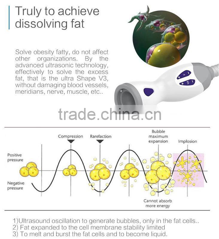 Ultrashape slimming HIFU/Ultrasonix body fat loss/Ultrashape Slimming machine