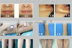 elight electric shaver for no hair removal beauty machine for women face body C001 (IPL+ rf)