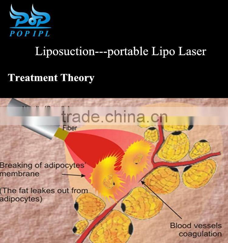 diode laser slimming machine popipl