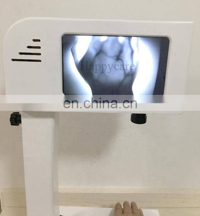 HC-G036 Best sale good quality vein finder/vein viewer price