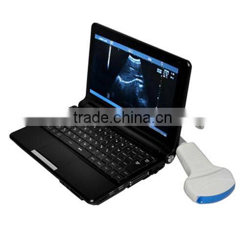low price Portable Ultrasound machine, mini laptop Ultrasound Scanner