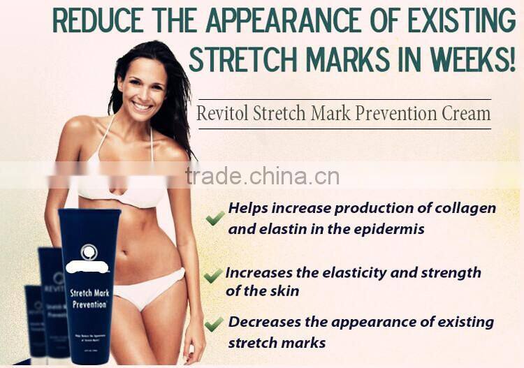 OEM slimming cream, stretch mark cream