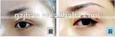 tattoo removal laser beauty equipment eyeline removal machine