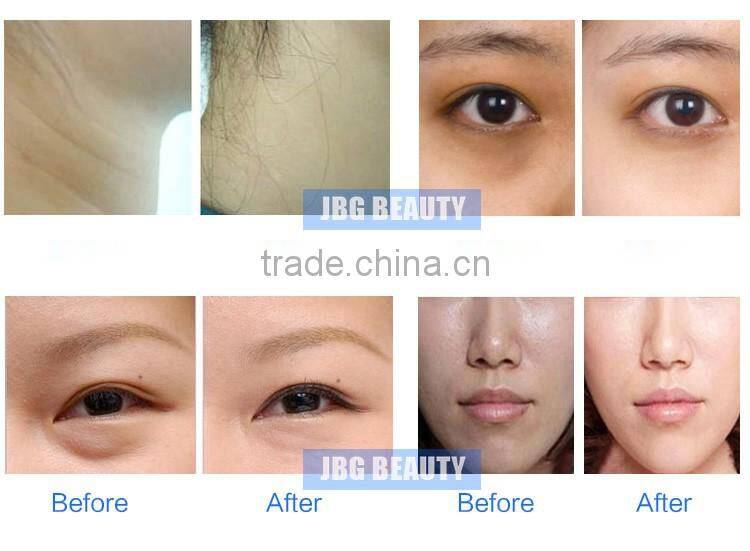 Hot new products in 2016 electric wrinkle removal face lifting facial massage machine manufacturer