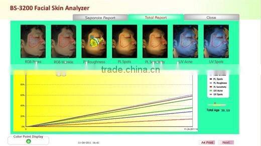 Hot-selling made in China smart system digital dermatoscope professional portable 3d skin analyzer