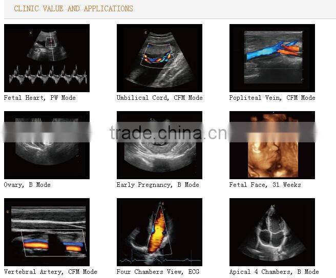 New Trolley 3D/4D Color Doppler Ultrasound Diagnostic System I3