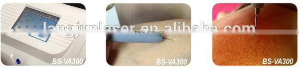 Beauty Therapy System HF or RF Vascular Vein Removal Treatment Device