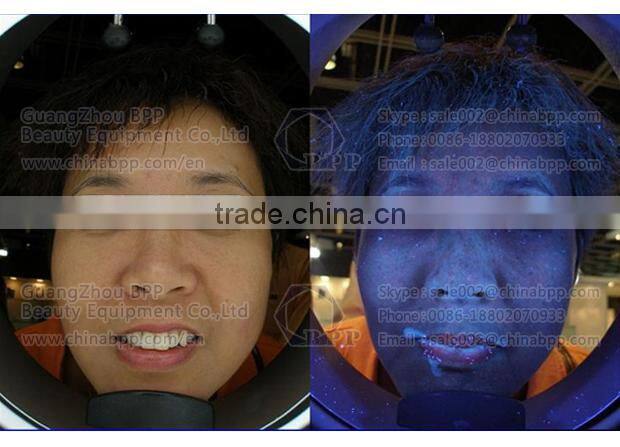 2015 Hot uv light facial skin analysis machine for speckles analysis