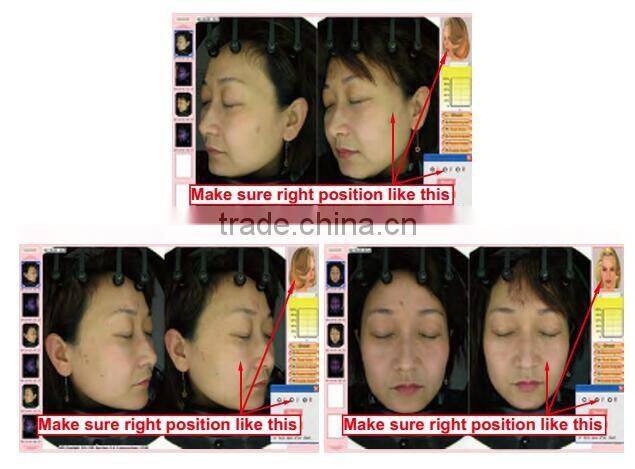 skin analyzer machine