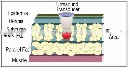 Cavitation Lose Weight Ultrasonic Cellulite Reduction