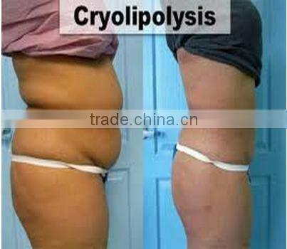 2014 professional portable slimming cavitation ultrasound machine price