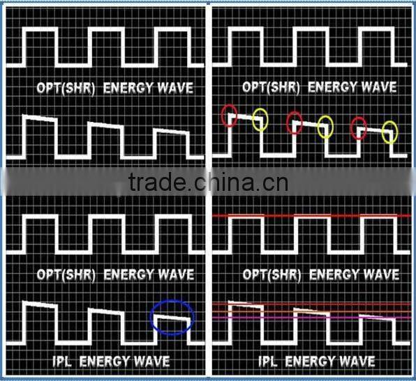 Germany tech ipl/rf hair removal machine with 1000000 shots hair removal