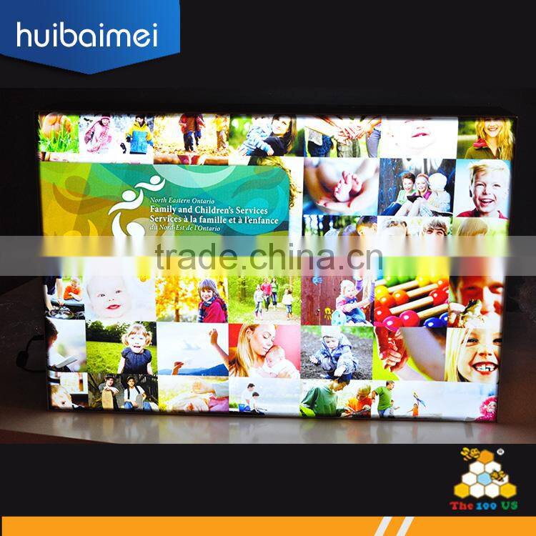 backlight led2835 led5730 advertising light boxes