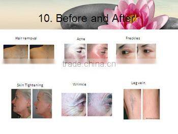 FDA elight ipl hair removal machine med-230