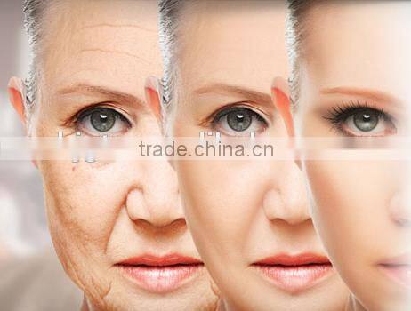 Medical CE Certification Derma Rolling System Derma Rolling Type Derma Roller