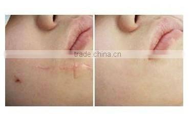 Hot selling !!! fractional co2 laser sun-damaged skin