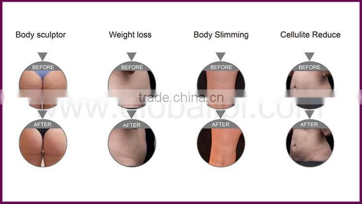 china beauty salon equipment ultrasound china with great price