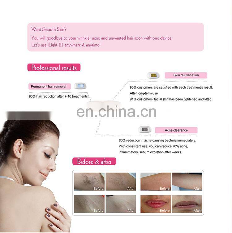 Multi IPL hair removal Permanent and one time hair removal !laser hair removal ipl