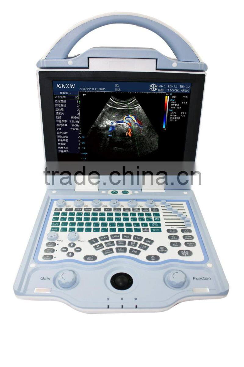 Cardiac Portable Ultrasound 3D 4D Ultrasound Scanner Color Doppler Ultrasound Machine Price