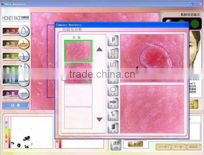 Hot-selling touch screen digital facial skin analyzer beauty machine BD-P006